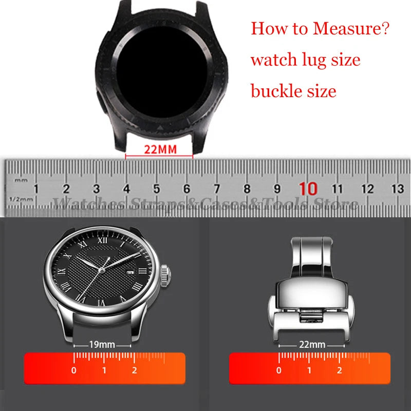 20‑Piece Quick-Release Watch Pins – 1.5/1.8mm, 12–24mm Spring Bars