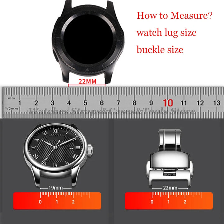 20‑Piece Quick-Release Watch Pins – 1.5/1.8mm, 12–24mm Spring Bars